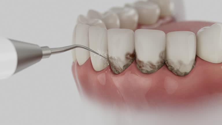 Trusted Teeth Cleaning And Checkup service in Florence, MT - Dentist Open Now